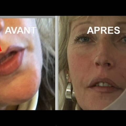 Comment avoir une belle bouche ?